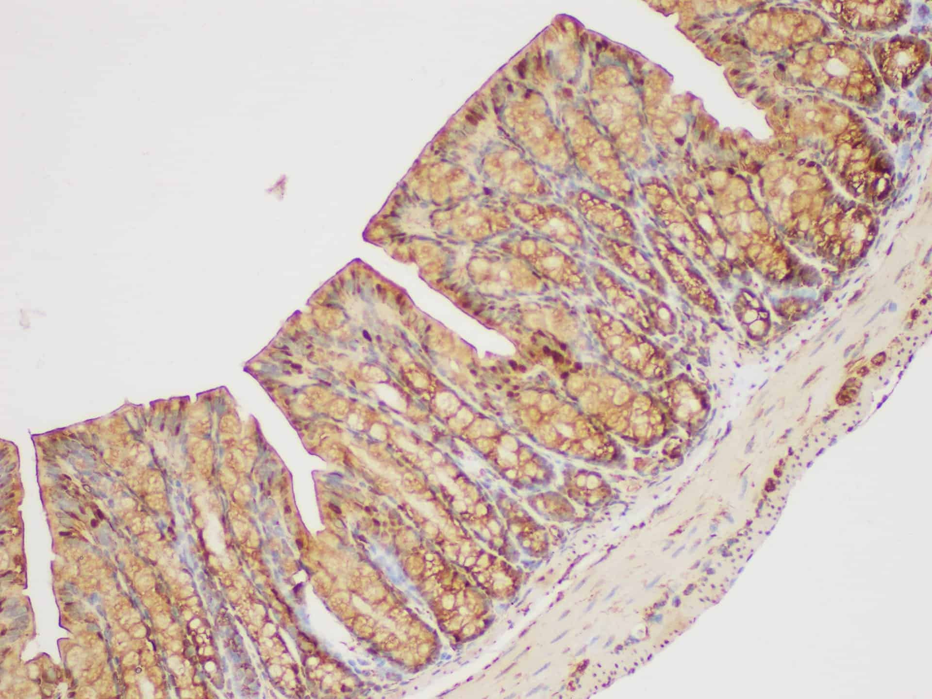 GAPDH Polyclonal Antibody Reactivity Human