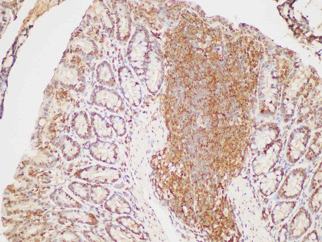 GAPDH Polyclonal Antibody Reactivity Human