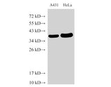 GAPDH Polyclonal Antibody Reactivity Human