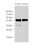 beta actin Polyclonal Antibody Host Rabbit