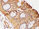 beta actin Polyclonal Antibody Host Rabbit