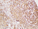 beta actin Polyclonal Antibody Host Rabbit
