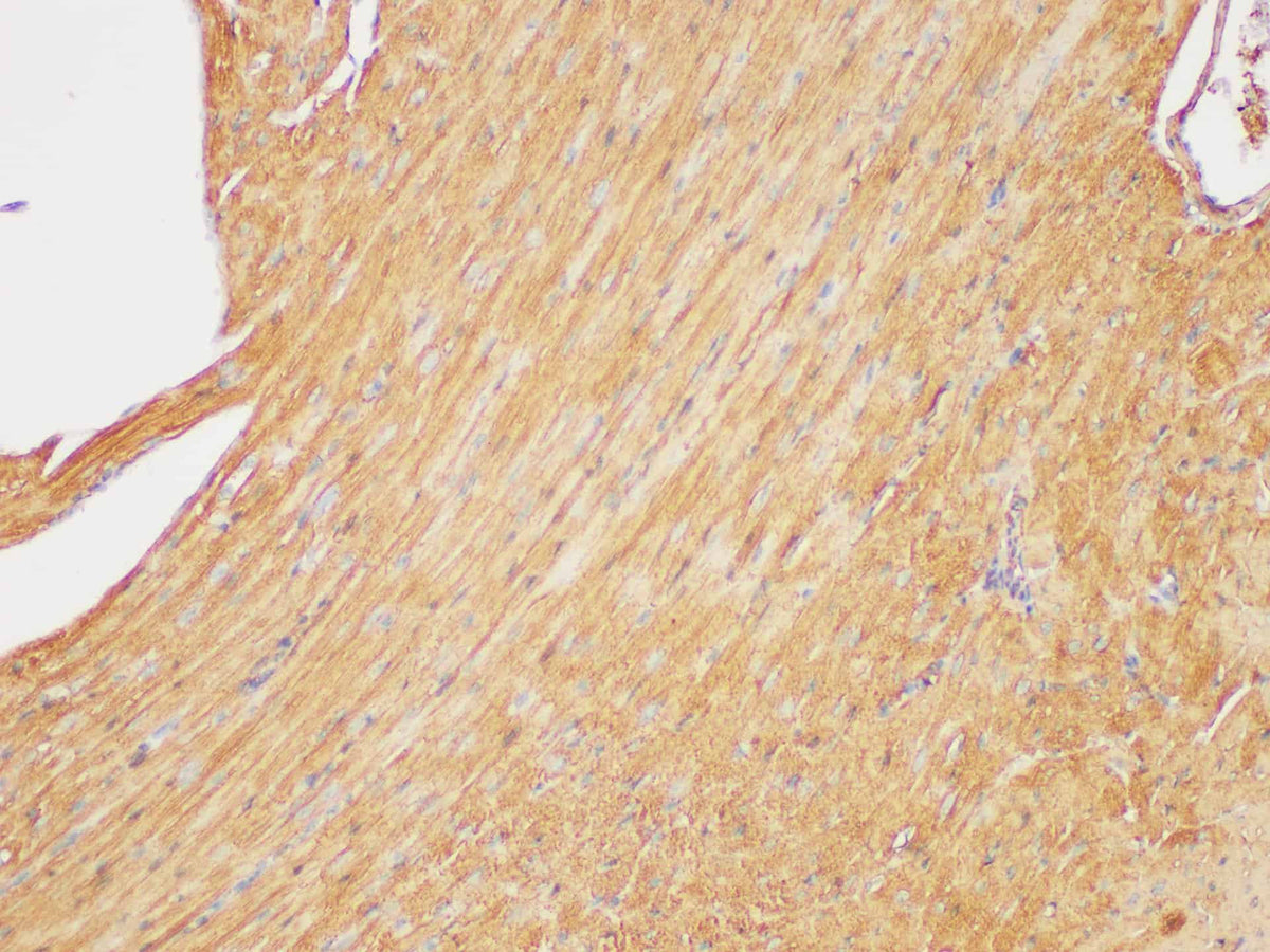 beta actin Polyclonal Antibody Host Rabbit