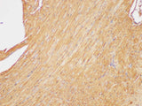beta actin Polyclonal Antibody Host Rabbit