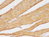 beta actin Polyclonal Antibody Host Rabbit