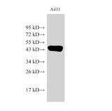 beta actin Polyclonal Antibody Host Rabbit