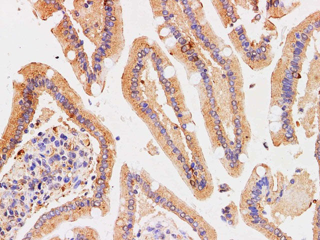 Chromogranin A Polyclonal Antibody Host Rabbit