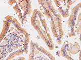 Chromogranin A Polyclonal Antibody Host Rabbit