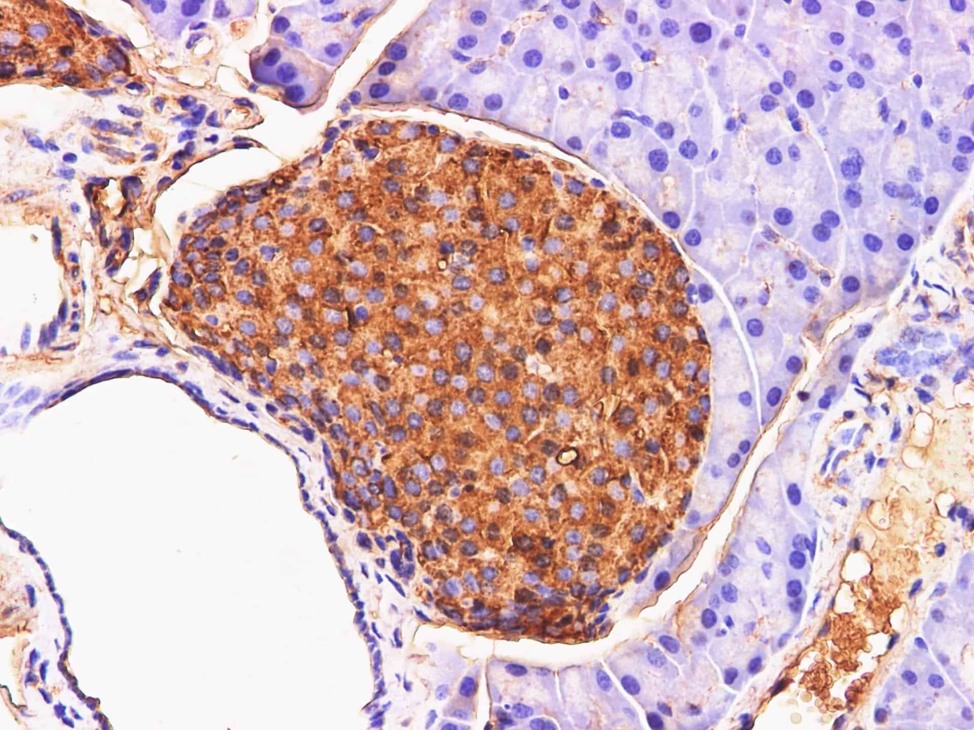 Chromogranin A Polyclonal Antibody Host Rabbit