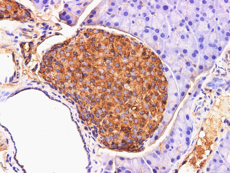 Chromogranin A Polyclonal Antibody Host Rabbit