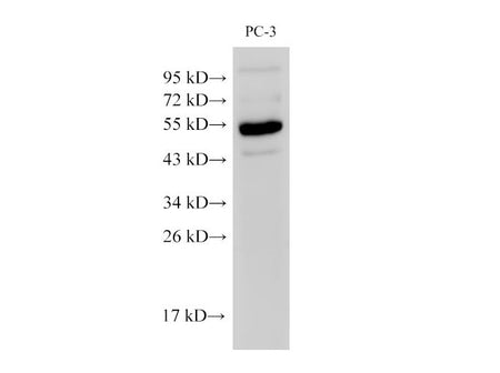 Chromogranin A Polyclonal Antibody Host Rabbit