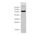 PDCD4 Polyclonal Antibody Host Rabbit