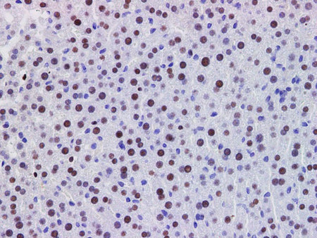 PDCD4 Polyclonal Antibody Host Rabbit