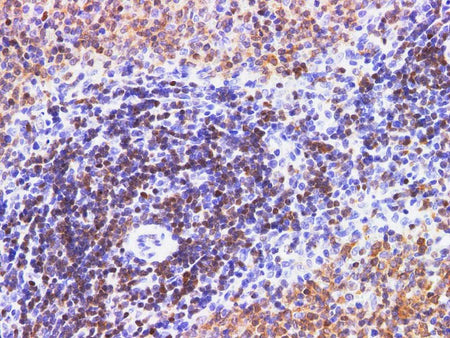 PDCD4 Polyclonal Antibody Host Rabbit