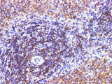 PDCD4 Polyclonal Antibody Host Rabbit
