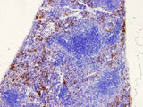 S100A9 Polyclonal Antibody Host Rabbit