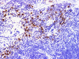 S100A9 Polyclonal Antibody Host Rabbit