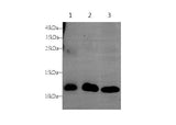 S100A9 Polyclonal Antibody Host Rabbit