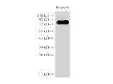 IL6R Polyclonal Antibody