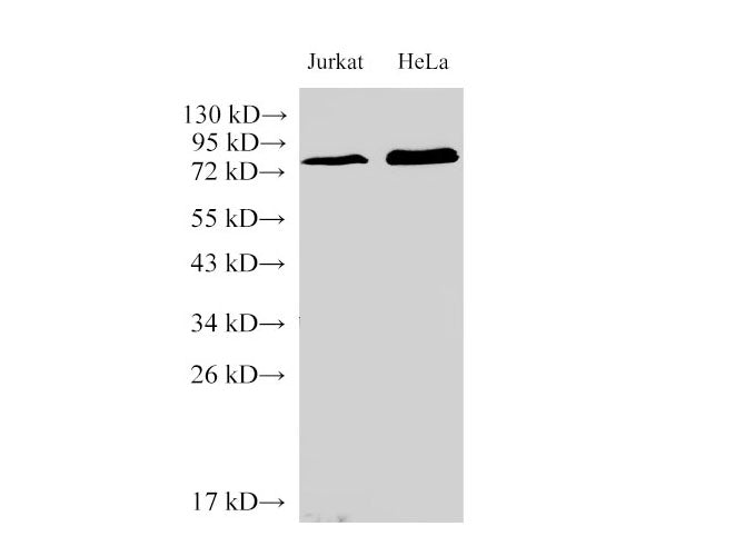 IL6R Polyclonal Antibody