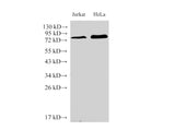 IL6R Polyclonal Antibody
