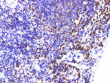 IL6R Polyclonal Antibody