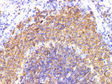 IL6R Polyclonal Antibody