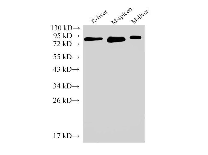 IL6R Polyclonal Antibody