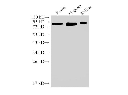 IL6R Polyclonal Antibody