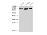 IL6R Polyclonal Antibody