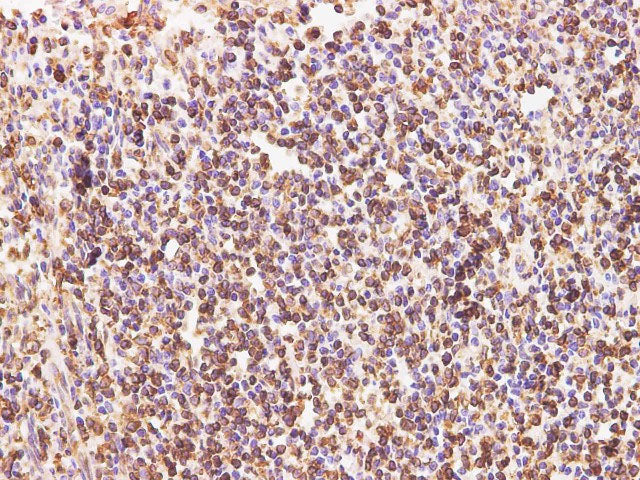 CD74 Polyclonal Antibody