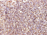 CD74 Polyclonal Antibody