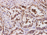 CD74 Polyclonal Antibody
