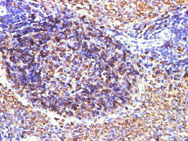CD74 Polyclonal Antibody