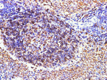 CD74 Polyclonal Antibody