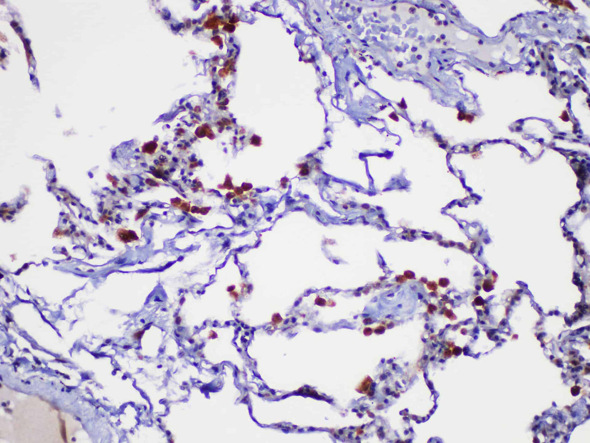 Galectin 3 Polyclonal Antibody Host Rabbit