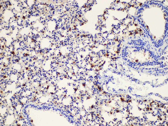 Galectin 3 Polyclonal Antibody Host Rabbit