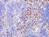Galectin 3 Polyclonal Antibody Host Rabbit