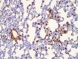 Galectin 3 Polyclonal Antibody Host Rabbit