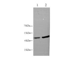 MVD Polyclonal Antibody Host Rabbit