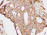 KLK6 Polyclonal Antibody Host Rabbit