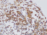 KLK6 Polyclonal Antibody Host Rabbit