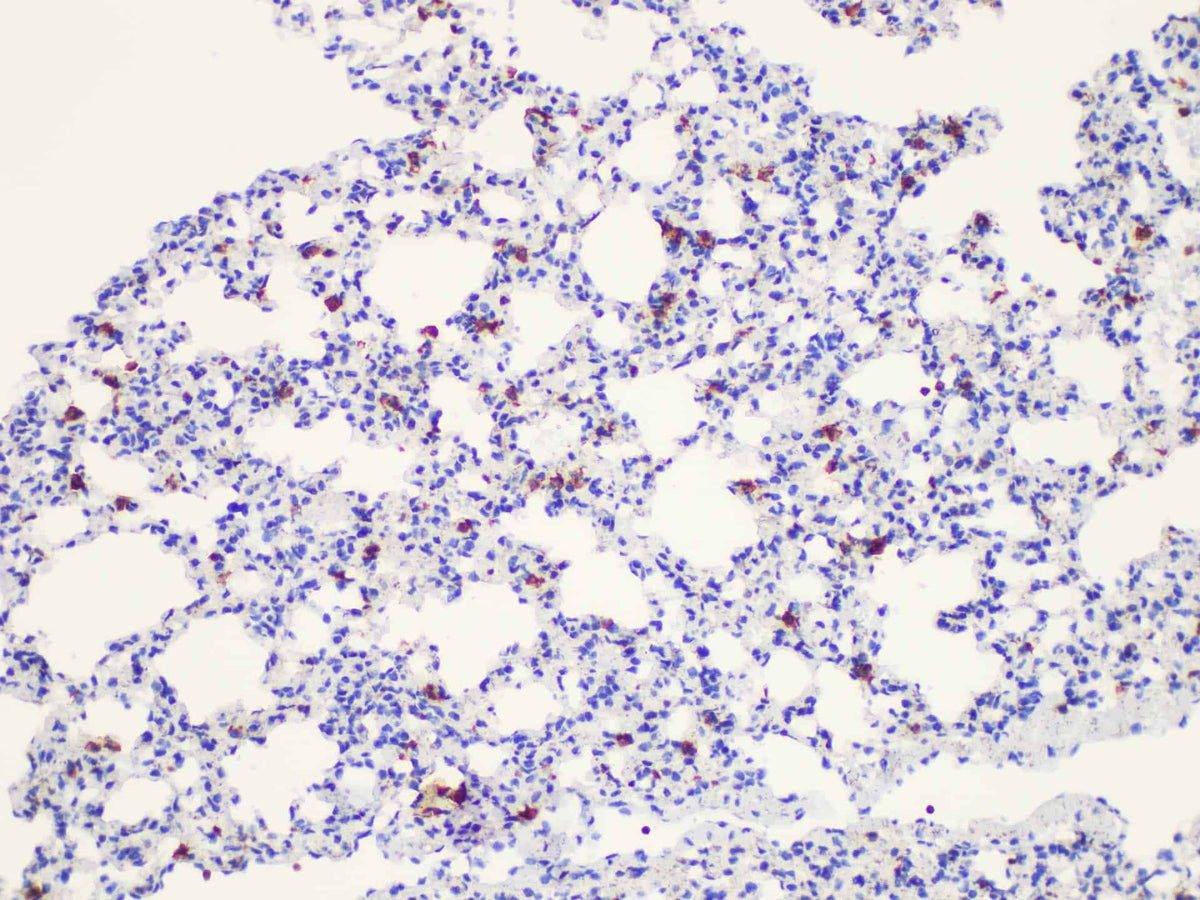 Galectin 3 Polyclonal Antibody Host Rabbit