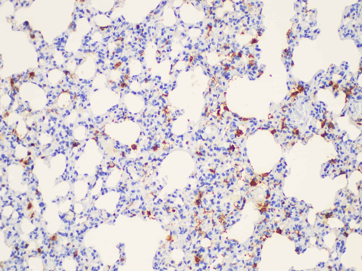 Galectin 3 Polyclonal Antibody Host Rabbit