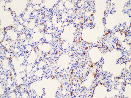 Galectin 3 Polyclonal Antibody Host Rabbit