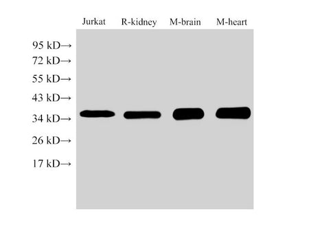 LDHB Polyclonal Antibody