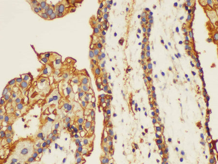 ANXA5 Polyclonal Antibody Reactivity Human