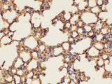 ANXA5 Polyclonal Antibody Reactivity Human