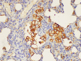 ANXA5 Polyclonal Antibody Reactivity Human
