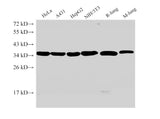 ANXA5 Polyclonal Antibody Reactivity Human